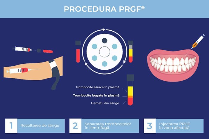 Centrifuga Endoret PRGF®