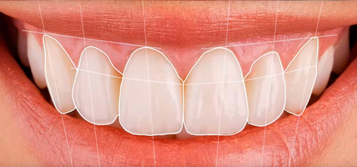 Digital Smile Design®