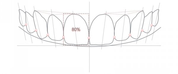 Digital Smile Design®