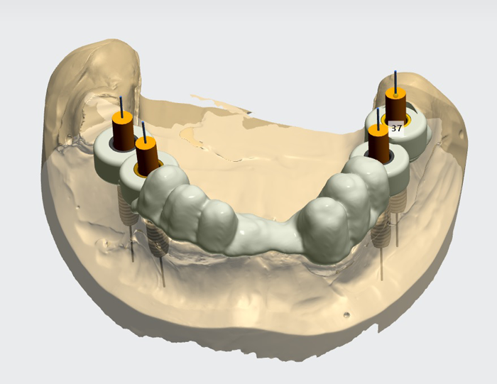 Ghid chirurgical digital