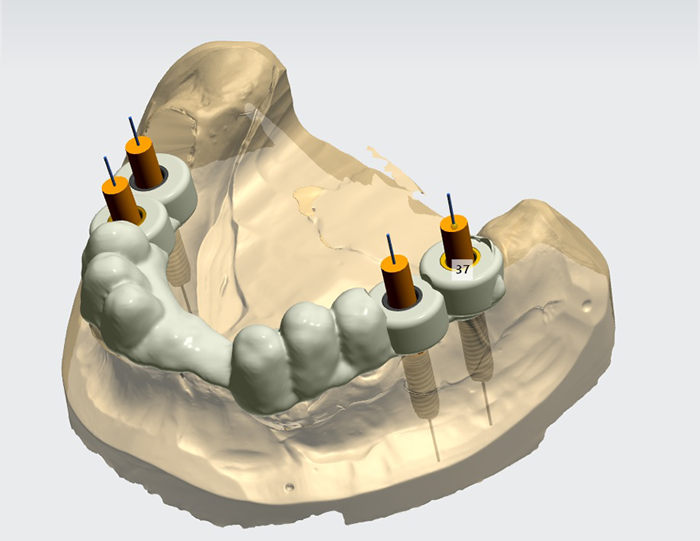 Ghid chirurgical digital