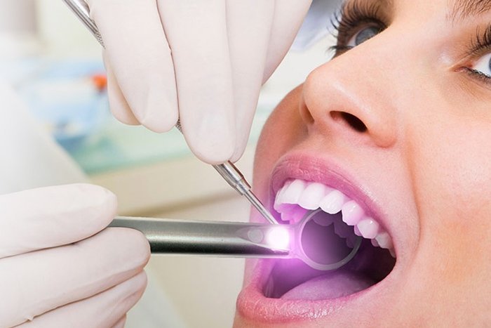 Oral cancer screening