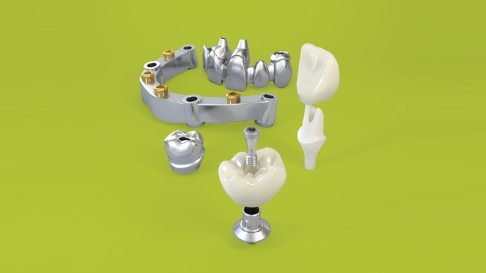 Implantul Straumann PRO Arch®