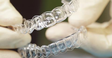 Când este necesar aparatul dentar?