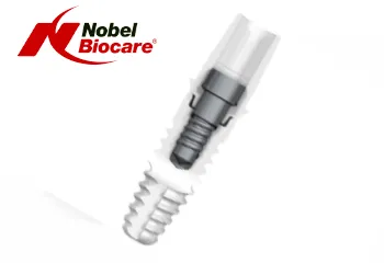 Implantul dentar NobelPearl®