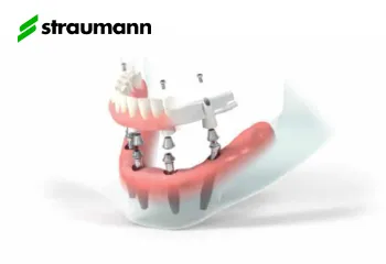 Implantul Straumann PRO Arch®