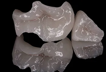 Incrustații dentare