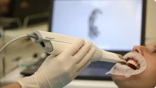 Scanner-ul intraoral digital Trios 3Shape© Real Color