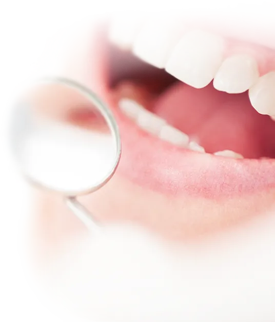 Dental prophylaxis Dental prophylaxis