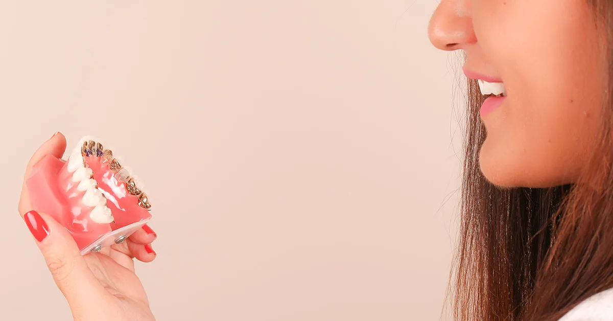 Urmezi un tratament ortodontic? Totul despre igienizarea aparatului dentar