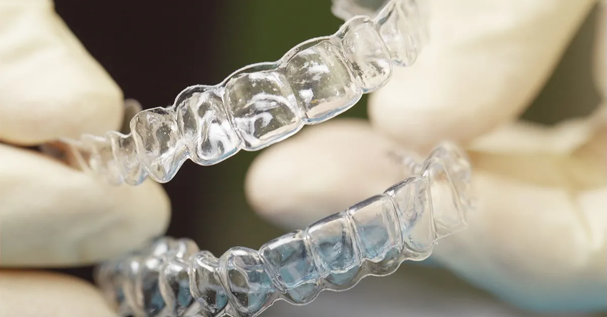 Când este necesar aparatul dentar?