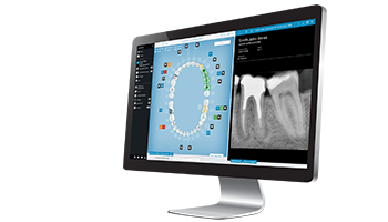 Implant dentar recomandat